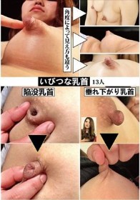 いびつな乳首